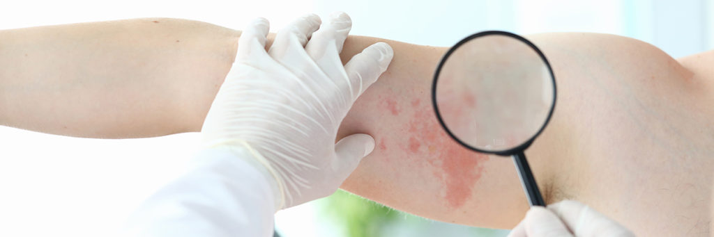 remboursement dermatologue
