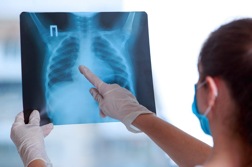 remboursements radiologie