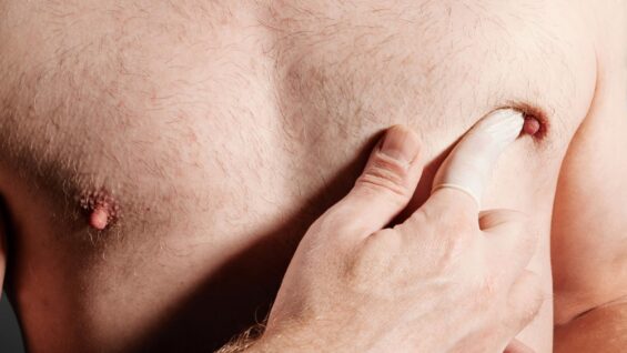 Le cancer du sein peut aussi « se conjuguer » au masculin