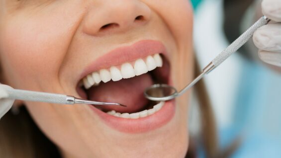 Les soins dentaires plus couteux depuis le 1er octobre