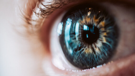 Cataracte : ce qu’il faut savoir sur l’implant intraoculaire