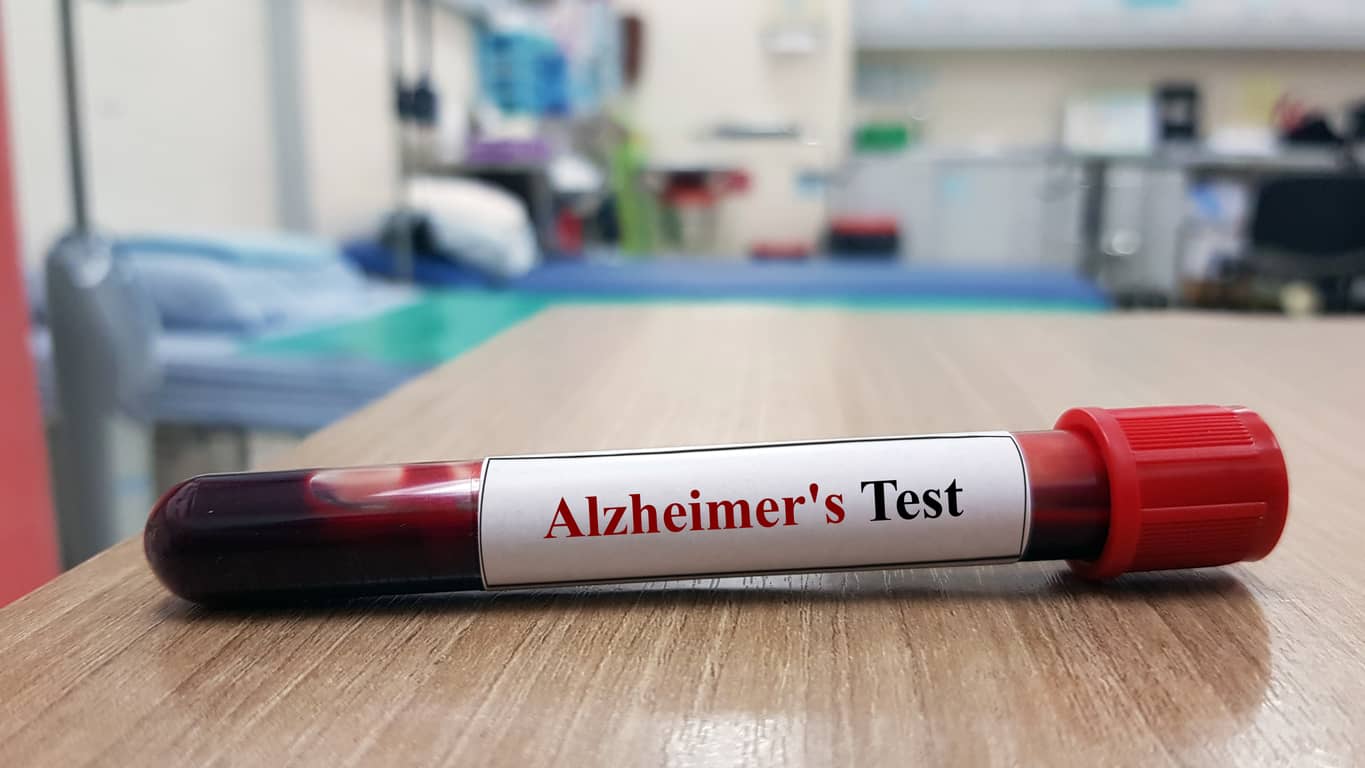 Vers une possibilité de diagnostiquer la maladie d’Alzheimer avec un nouveau test sanguin
