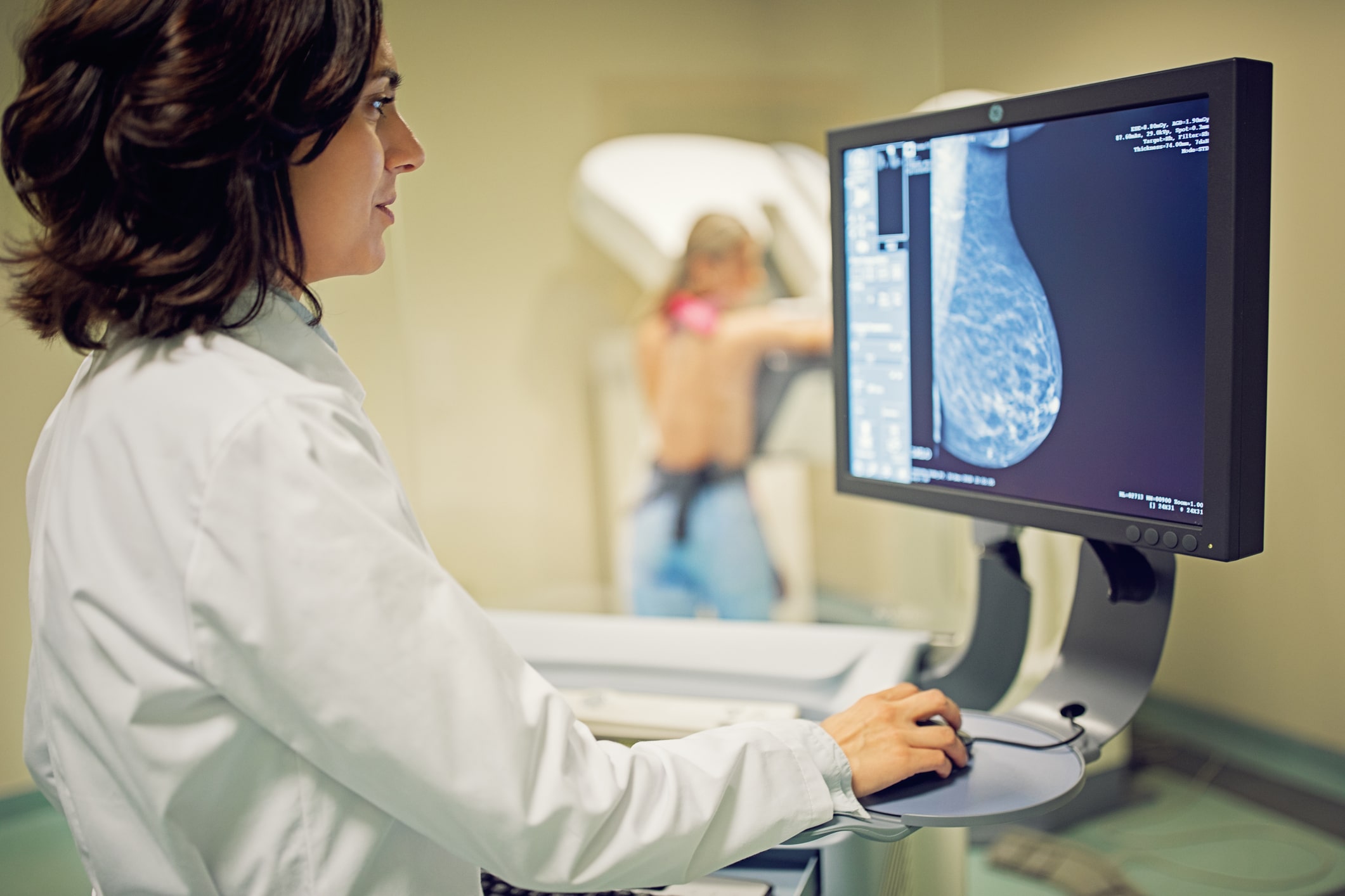 Dépistage du cancer du sein : encore un taux de participation peu satisfaisant